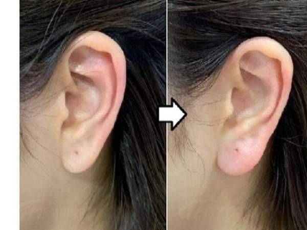 Người mà có tai lệch, thấp lõm chủ cả đời phá hoại tiêu tán.