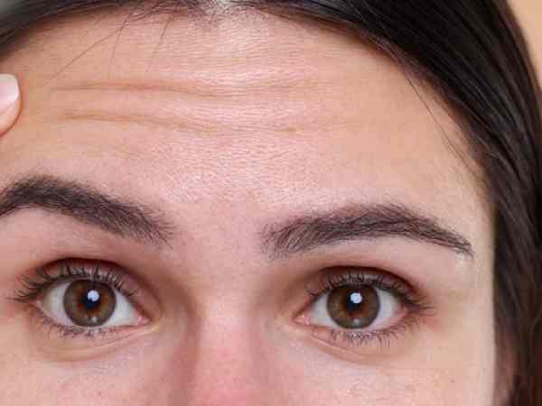 Nữ giới trán nhănNữ giới trán nhăn Nữ giới trán nhăn