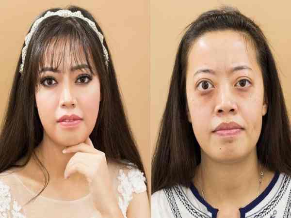 Tướng mắt trố kết hợp môi thâm Tướng mắt trố kết hợp môi thâm