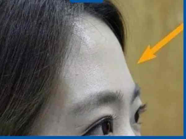 Tướng trán lõm là gì? Tướng trán lõm là gì?