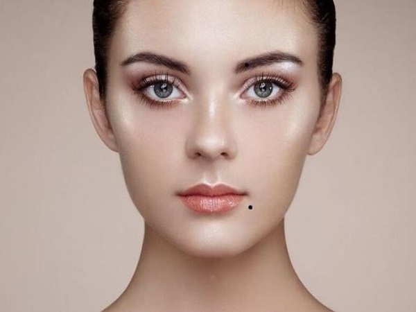 Nốt ruồi thị phi là gì?